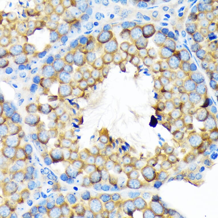 Immunohistochemistry - Anti-ALDH1A2 Antibody [ARC1797] (A307940) - Antibodies.com