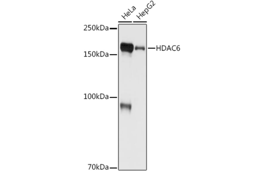 Western Blot - Anti-HDAC6 Antibody [ARC0805] (A307941) - Antibodies.com