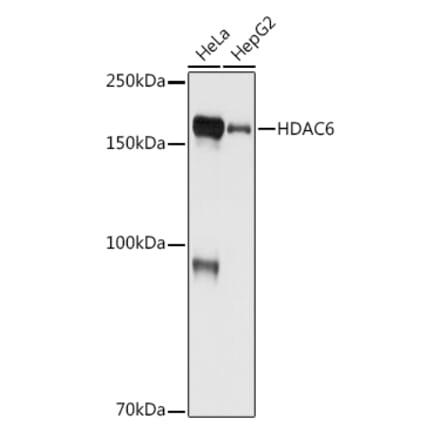 Western Blot - Anti-HDAC6 Antibody [ARC0805] (A307941) - Antibodies.com