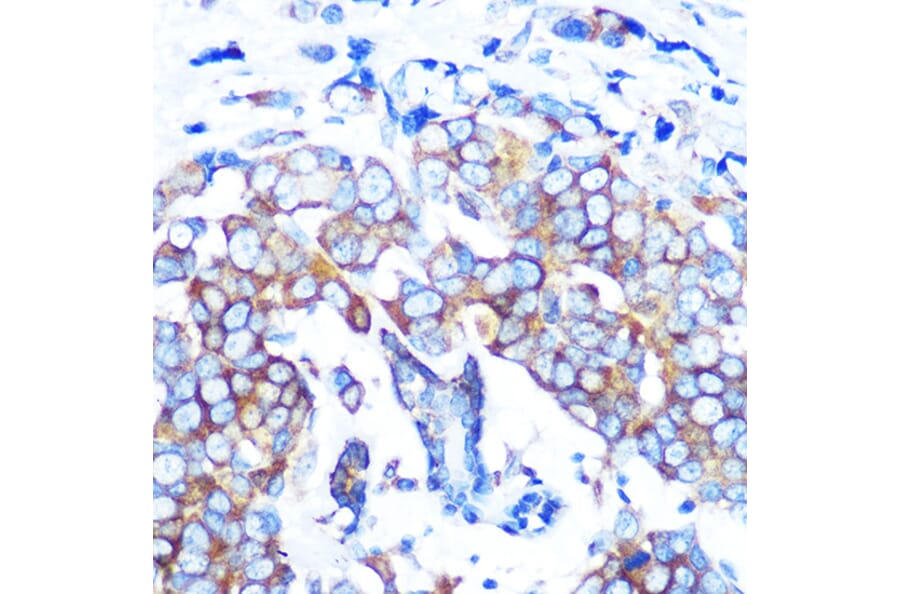 Immunohistochemistry - Anti-HDAC6 Antibody [ARC0805] (A307941) - Antibodies.com