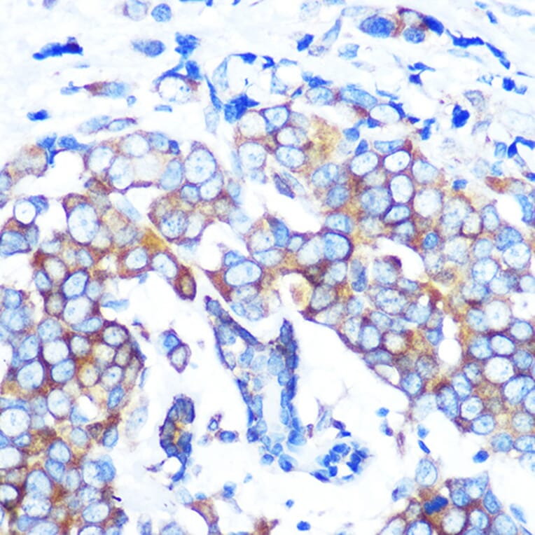 Immunohistochemistry - Anti-HDAC6 Antibody [ARC0805] (A307941) - Antibodies.com