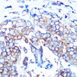 Immunohistochemistry - Anti-HDAC6 Antibody [ARC0805] (A307941) - Antibodies.com