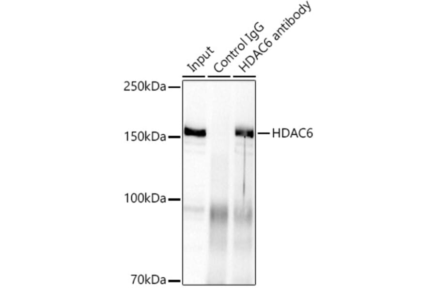 Western Blot - Anti-HDAC6 Antibody [ARC0805] (A307941) - Antibodies.com