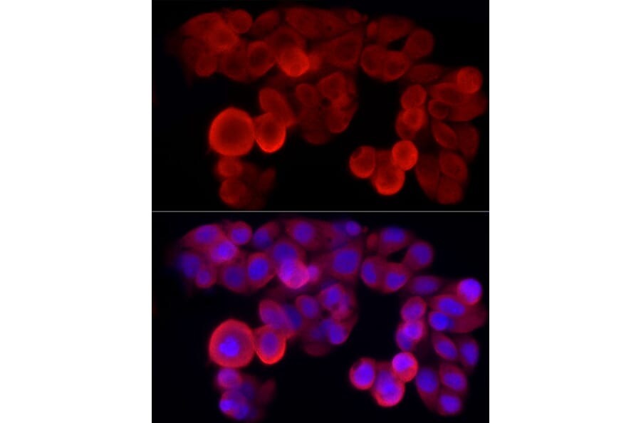 Immunofluorescence - Anti-NLRP3 Antibody (A307942) - Antibodies.com