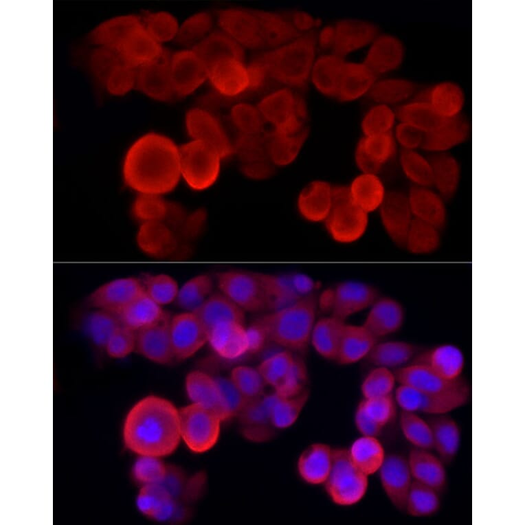 Immunofluorescence - Anti-NLRP3 Antibody (A307942) - Antibodies.com