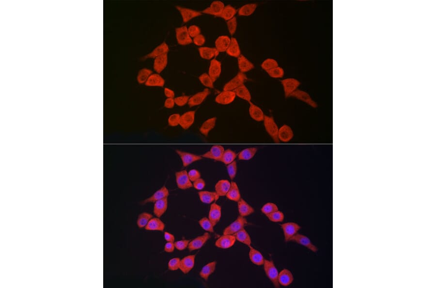 Immunofluorescence - Anti-NLRP3 Antibody (A307942) - Antibodies.com