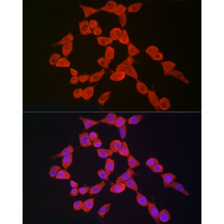 Immunofluorescence - Anti-NLRP3 Antibody (A307942) - Antibodies.com