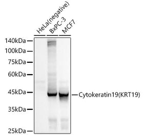 Western Blot - Anti-Cytokeratin 19 Antibody [ARC2811] (A307943) - Antibodies.com