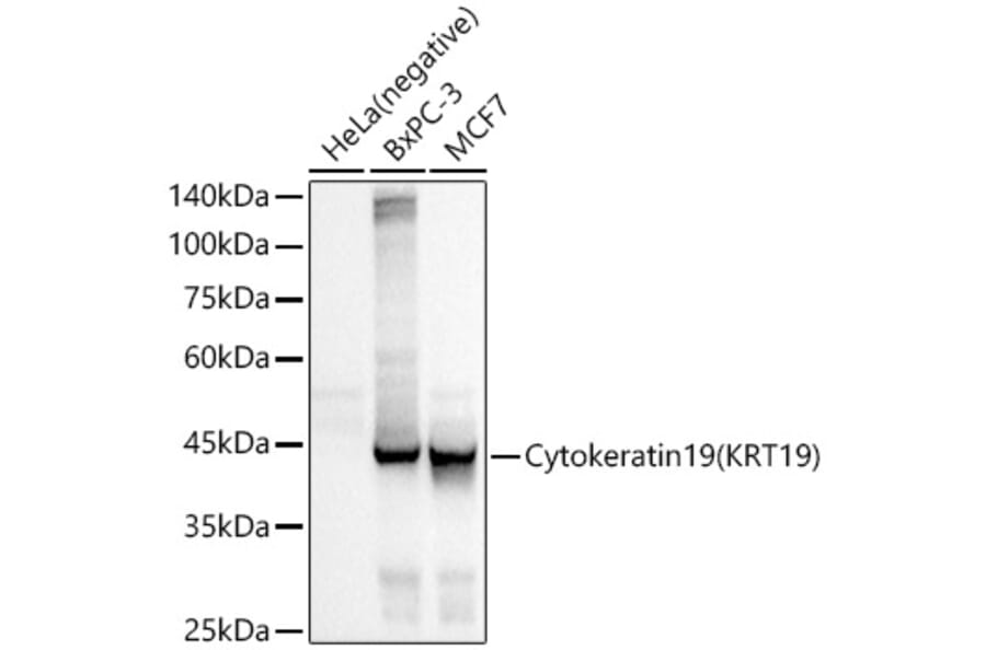 Western Blot - Anti-Cytokeratin 19 Antibody [ARC2811] (A307943) - Antibodies.com