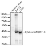 Western Blot - Anti-Cytokeratin 19 Antibody [ARC2811] (A307943) - Antibodies.com