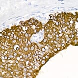 Immunohistochemistry - Anti-Cytokeratin 19 Antibody [ARC2811] (A307943) - Antibodies.com