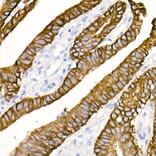 Immunohistochemistry - Anti-Cytokeratin 19 Antibody [ARC2811] (A307943) - Antibodies.com