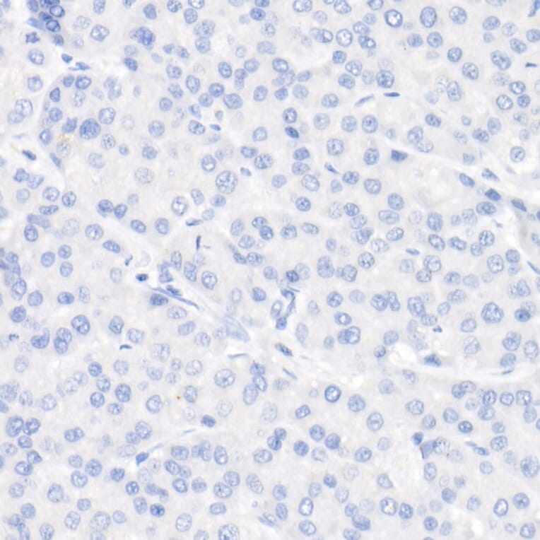 Immunohistochemistry - Anti-Cytokeratin 19 Antibody [ARC2811] (A307943) - Antibodies.com