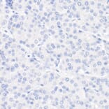 Immunohistochemistry - Anti-Cytokeratin 19 Antibody [ARC2811] (A307943) - Antibodies.com