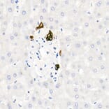 Immunohistochemistry - Anti-Cytokeratin 19 Antibody [ARC2811] (A307943) - Antibodies.com