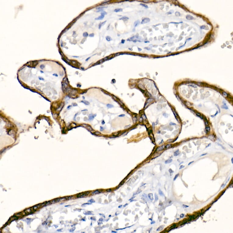 Immunohistochemistry - Anti-Cytokeratin 19 Antibody [ARC2811] (A307943) - Antibodies.com