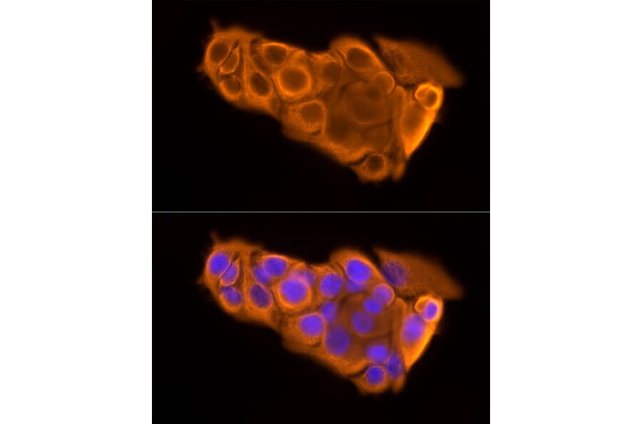 Immunofluorescence - Anti-Cytokeratin 19 Antibody [ARC2811] (A307943) - Antibodies.com