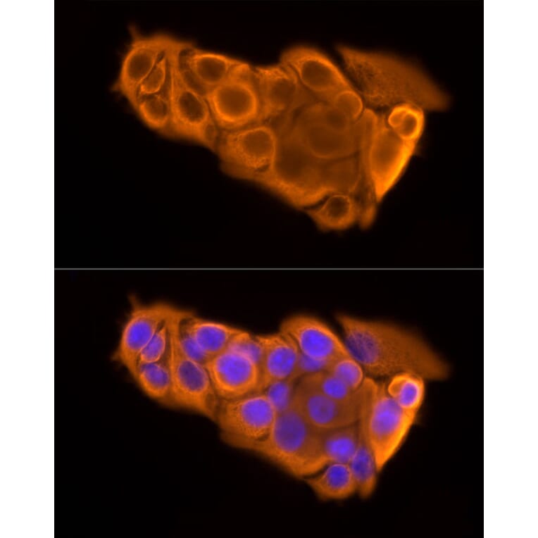 Immunofluorescence - Anti-Cytokeratin 19 Antibody [ARC2811] (A307943) - Antibodies.com