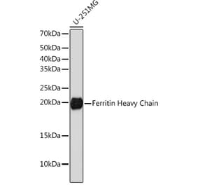 Western Blot - Anti-Ferritin Heavy Chain Antibody [ARC0023] (A307944) - Antibodies.com