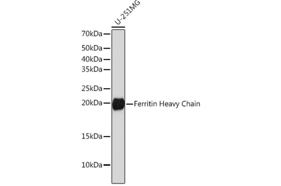 Western Blot - Anti-Ferritin Heavy Chain Antibody [ARC0023] (A307944) - Antibodies.com