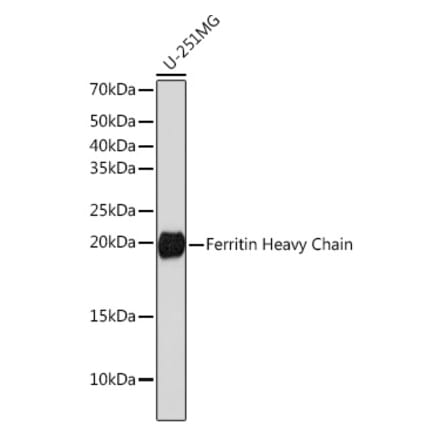 Western Blot - Anti-Ferritin Heavy Chain Antibody [ARC0023] (A307944) - Antibodies.com