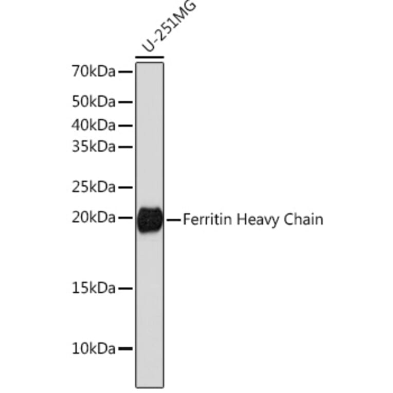 Western Blot - Anti-Ferritin Heavy Chain Antibody [ARC0023] (A307944) - Antibodies.com