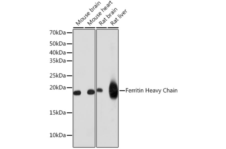 Western Blot - Anti-Ferritin Heavy Chain Antibody [ARC0023] (A307944) - Antibodies.com