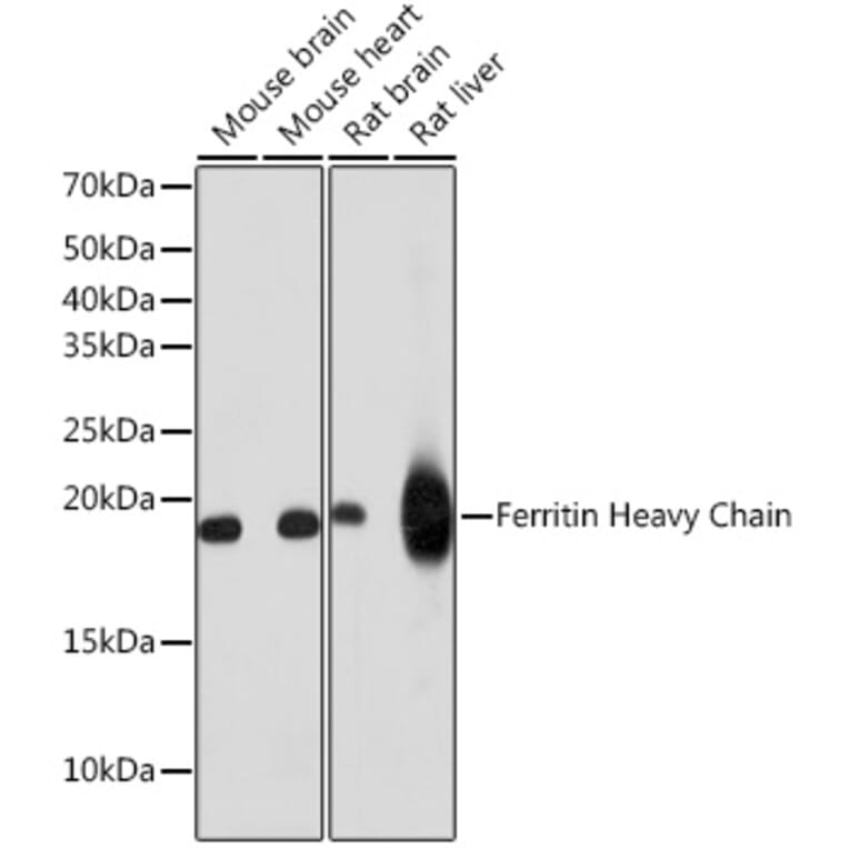 Western Blot - Anti-Ferritin Heavy Chain Antibody [ARC0023] (A307944) - Antibodies.com