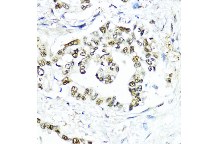 Immunohistochemistry - Anti-Sumo 1 Antibody (A307946) - Antibodies.com