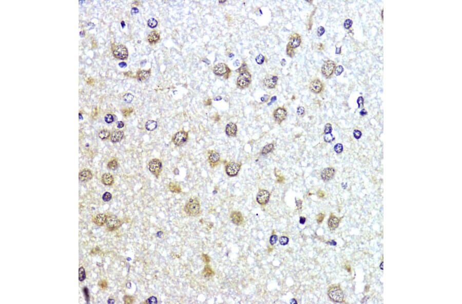 Immunohistochemistry - Anti-Sumo 1 Antibody (A307946) - Antibodies.com