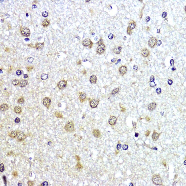 Immunohistochemistry - Anti-Sumo 1 Antibody (A307946) - Antibodies.com