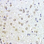 Immunohistochemistry - Anti-Sumo 1 Antibody (A307946) - Antibodies.com