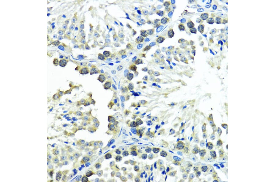 Immunohistochemistry - Anti-Sumo 1 Antibody (A307946) - Antibodies.com