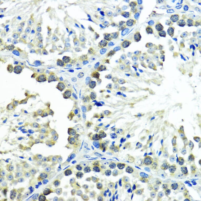 Immunohistochemistry - Anti-Sumo 1 Antibody (A307946) - Antibodies.com