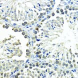 Immunohistochemistry - Anti-Sumo 1 Antibody (A307946) - Antibodies.com