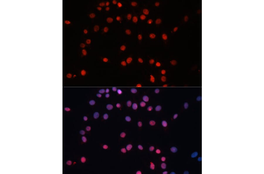 Immunofluorescence - Anti-Sumo 1 Antibody (A307946) - Antibodies.com