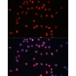 Immunofluorescence - Anti-Sumo 1 Antibody (A307946) - Antibodies.com