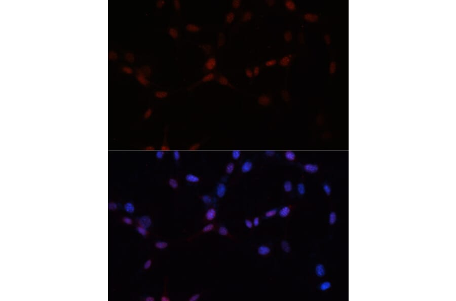 Immunofluorescence - Anti-Sumo 1 Antibody (A307946) - Antibodies.com