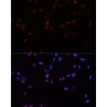 Immunofluorescence - Anti-Sumo 1 Antibody (A307946) - Antibodies.com