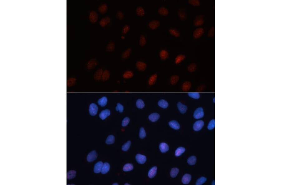 Immunofluorescence - Anti-Sumo 1 Antibody (A307946) - Antibodies.com