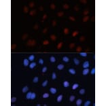 Immunofluorescence - Anti-Sumo 1 Antibody (A307946) - Antibodies.com