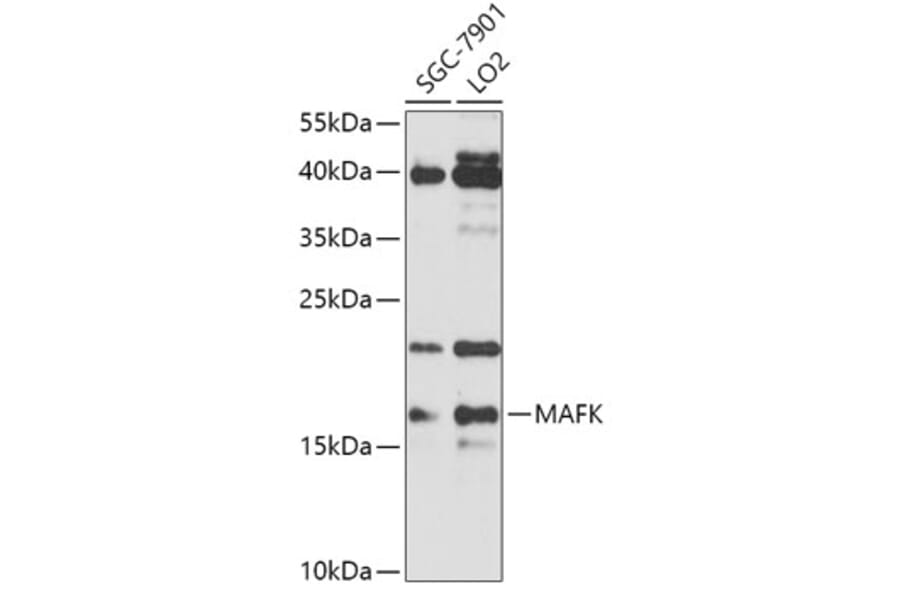 Western Blot - Anti-MAFK Antibody (A307947) - Antibodies.com