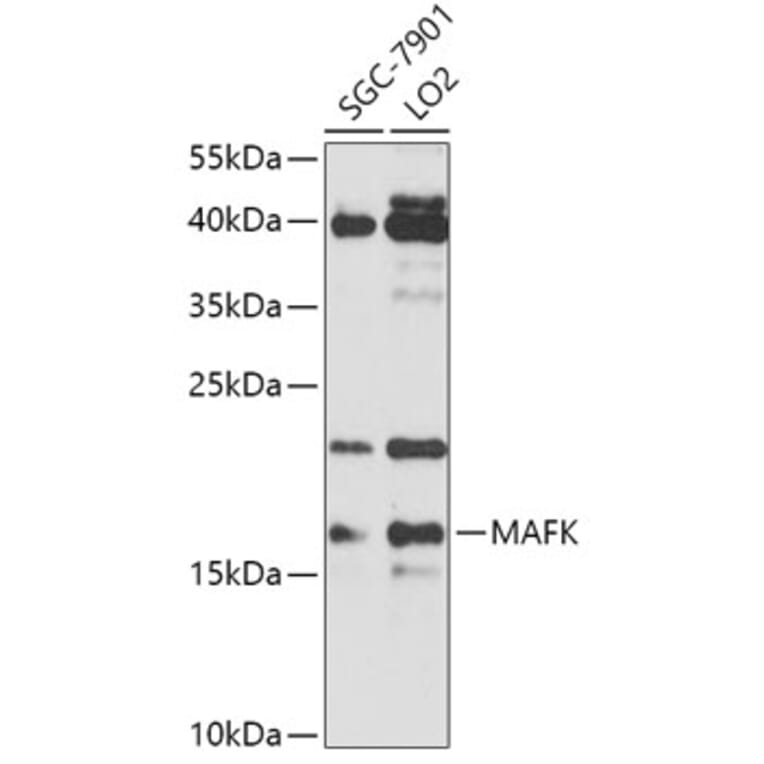 Western Blot - Anti-MAFK Antibody (A307947) - Antibodies.com