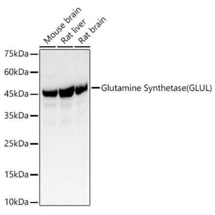 Western Blot - Anti-Glutamine Synthetase Antibody (A307948) - Antibodies.com