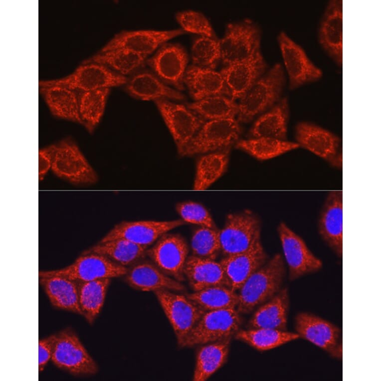 Immunofluorescence - Anti-Glutamine Synthetase Antibody (A307948) - Antibodies.com