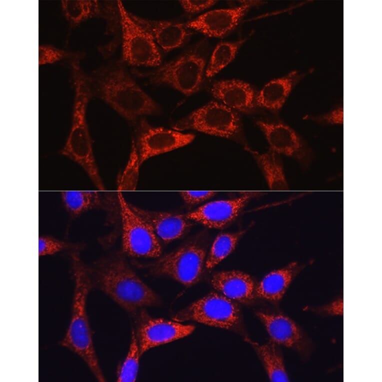 Immunofluorescence - Anti-Glutamine Synthetase Antibody (A307948) - Antibodies.com