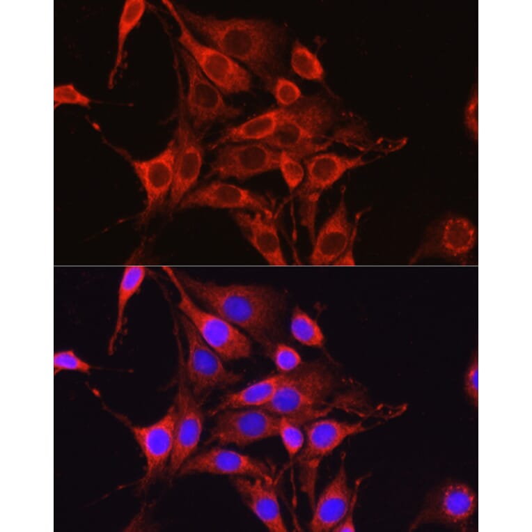 Immunofluorescence - Anti-Glutamine Synthetase Antibody (A307948) - Antibodies.com
