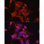 Immunofluorescence - Anti-Glutamine Synthetase Antibody (A307948) - Antibodies.com