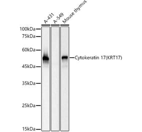 Western Blot - Anti-Cytokeratin 17 Antibody [ARC0271] (A307949) - Antibodies.com