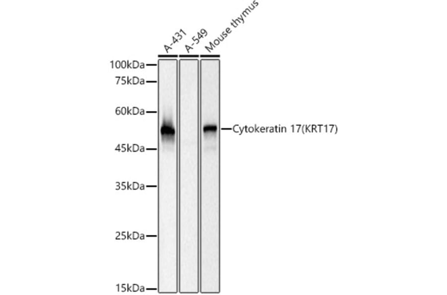 Western Blot - Anti-Cytokeratin 17 Antibody [ARC0271] (A307949) - Antibodies.com